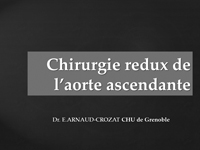 Chirurgie redux de l'aorte ascendante