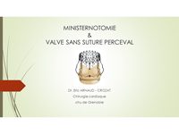 Ministernotomie et Valve sans suture Perceval